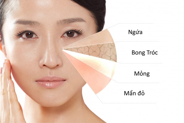 Toner cho da nhạy cảm